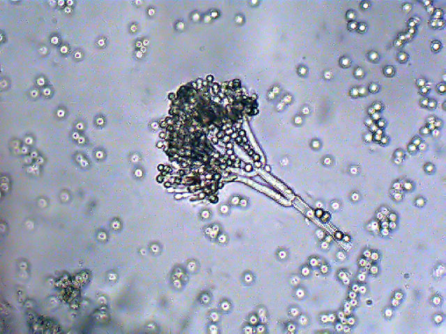 Mofo observado por um microscópio - microscopy.uk.org
